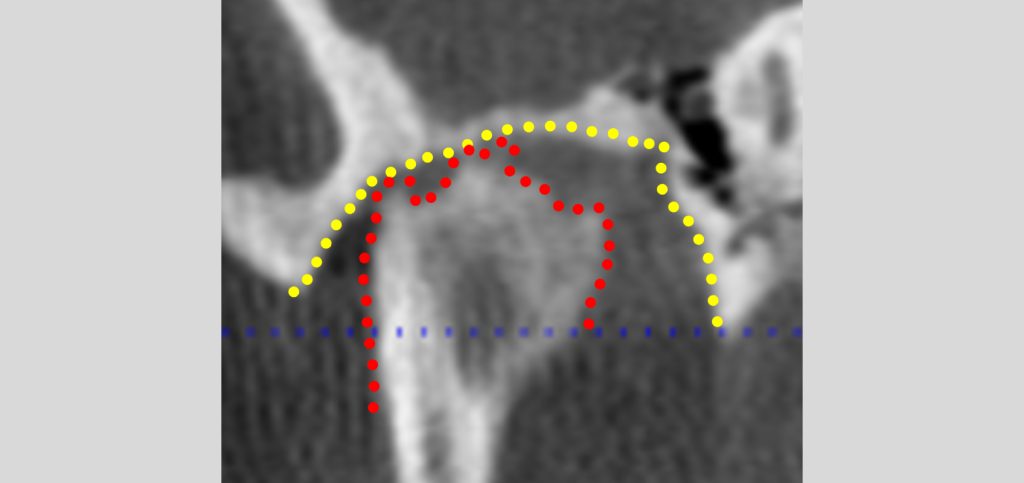 What Is Centric Relation? Jim McKee What Is Centric Relation Figure 2