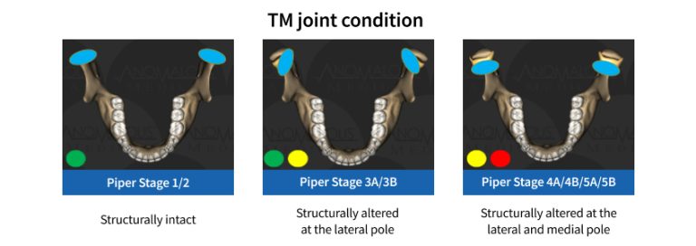 Should I Be Thinking About TM Imaging? - Spear Education