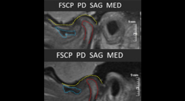 JimMcKee tm joint imaging part 2 examining a clinical case FeaturedImage