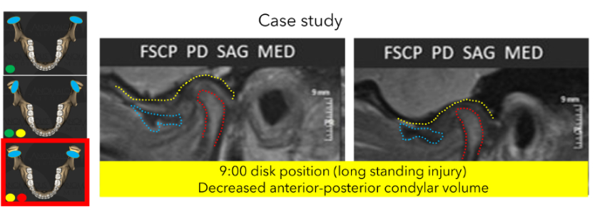 JimMcKee tm joint imaging part 2 examining a clinical case Fig.5