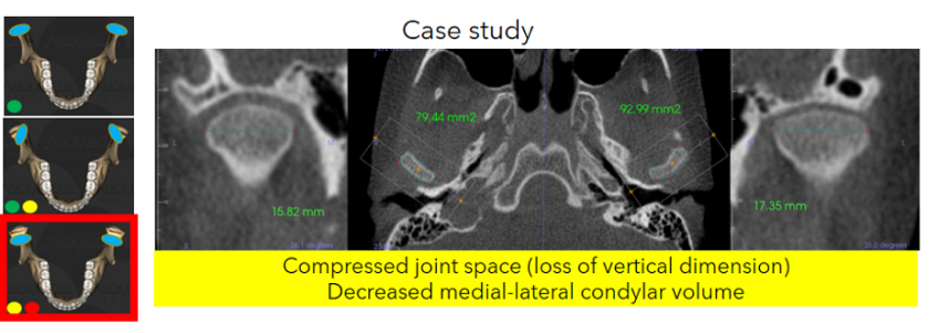 JimMcKee tm joint imaging part 2 examining a clinical case Fig.6