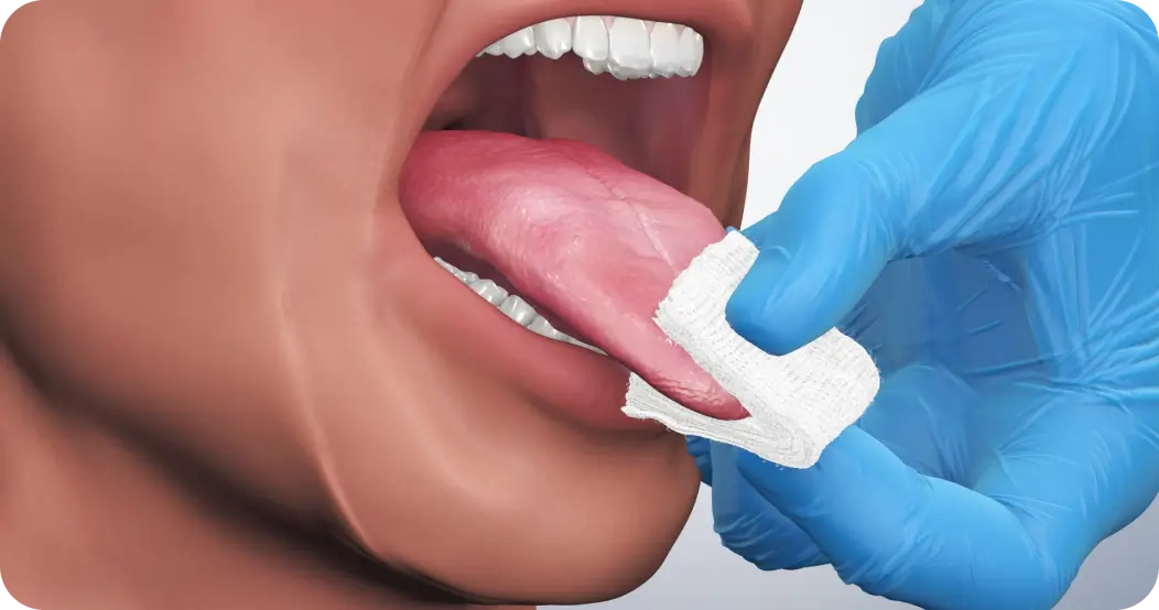 Oral Cancer Screening