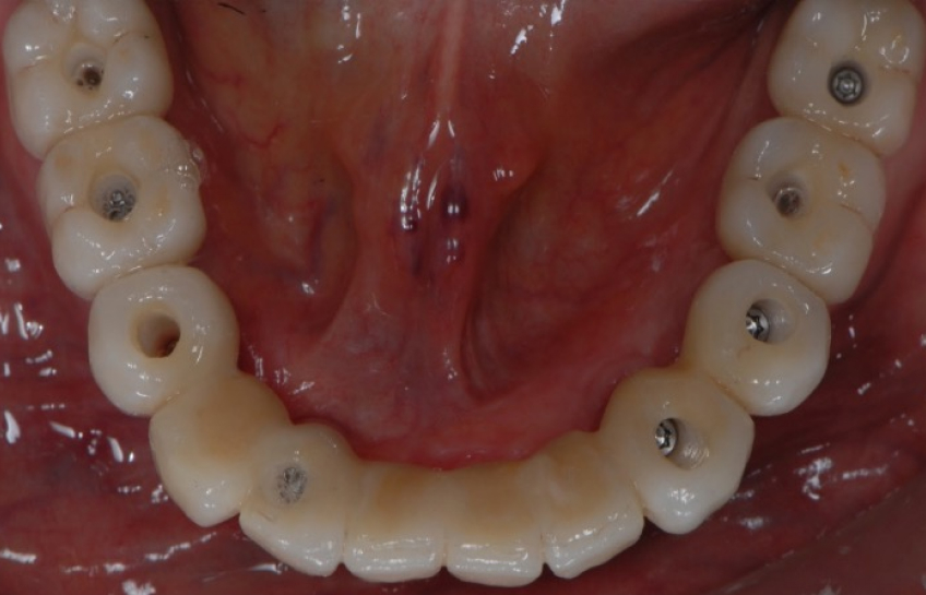 Ricardo Mitrani The Curse of Knowledge Improving Dental Patient Communication Figure 1