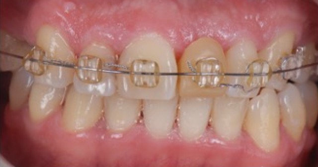 RicardoMitrani dental patient compliance and adherence impacts on outcomes and costs FeaturedImage