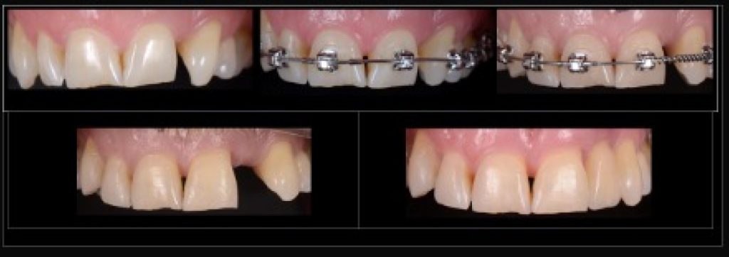 RicardoMitrani dental patient compliance and adherence impacts on outcomes and costs Fig.1 1