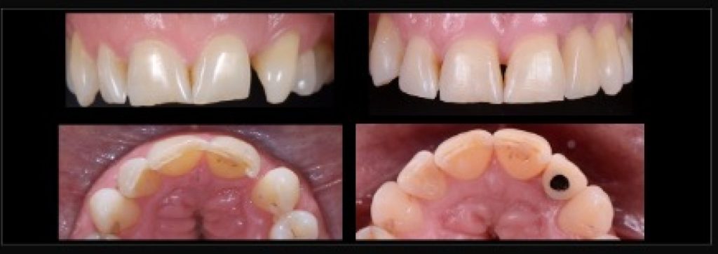 RicardoMitrani dental patient compliance and adherence impacts on outcomes and costs Fig.2 2