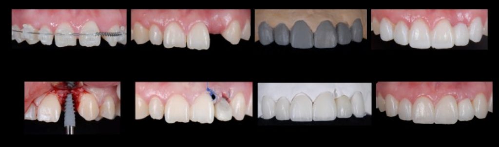 RicardoMitrani dental patient compliance and adherence impacts on outcomes and costs Fig.3 2