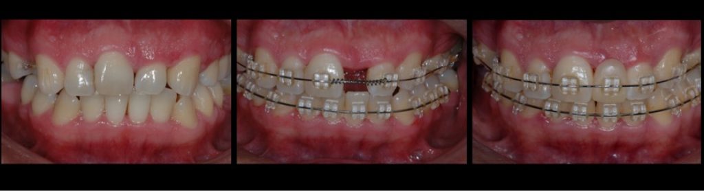 RicardoMitrani dental patient compliance and adherence impacts on outcomes and costs Fig.4 4