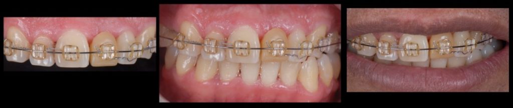 RicardoMitrani dental patient compliance and adherence impacts on outcomes and costs Fig.5