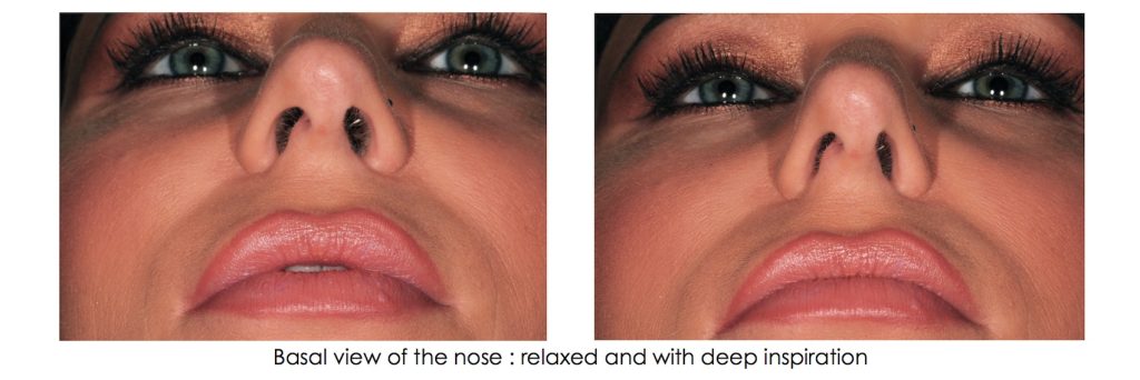 Supplemental Photographs for Airway Screening Winter Supplemental Photos Fig 4