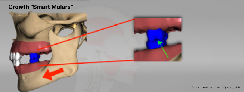 Dr. Mark Piper described the adult first molars as “smart molars” and emphasized how the interaction between them stimulates growth of the condyle. 