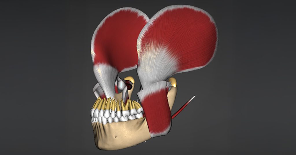 Why Do Jaws Hurt? Rethinking Orofacial Pain in the 3D Imaging Era Digest Featured McKee Jaw Pain