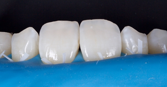 Digest Featured Smithson Adhesion Part 2.20251202152948669