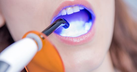 Spear Digest Digest Featured Smithson Adhesion Part 3 1