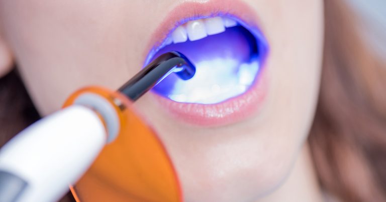 Digest Featured Smithson Adhesion Part 3