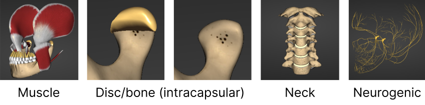 Why Do Jaws Hurt? Rethinking Orofacial Pain in the 3D Imaging Era Digest McKee Jaw Pain Fig 1