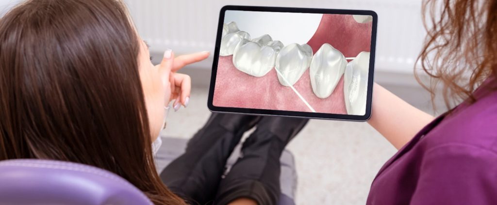 Empowered Dental Hygienists Are Shaping the Future Dental hygienist explaining treatment using digital visuals, highlighting the evolving dental hygienist role in hygienist-led care and oral systemic health.