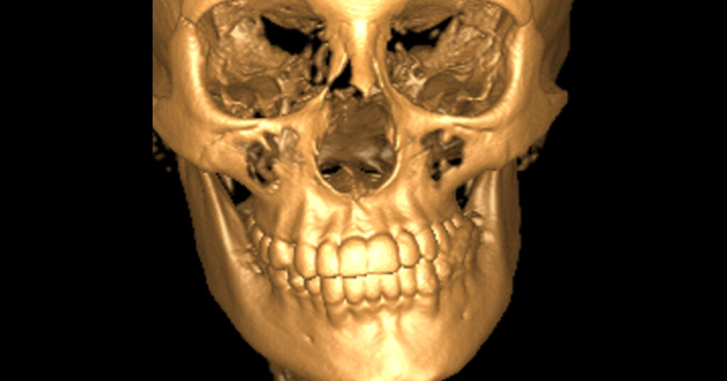 Digest Featured TMJ Disc Craniofacial Growth