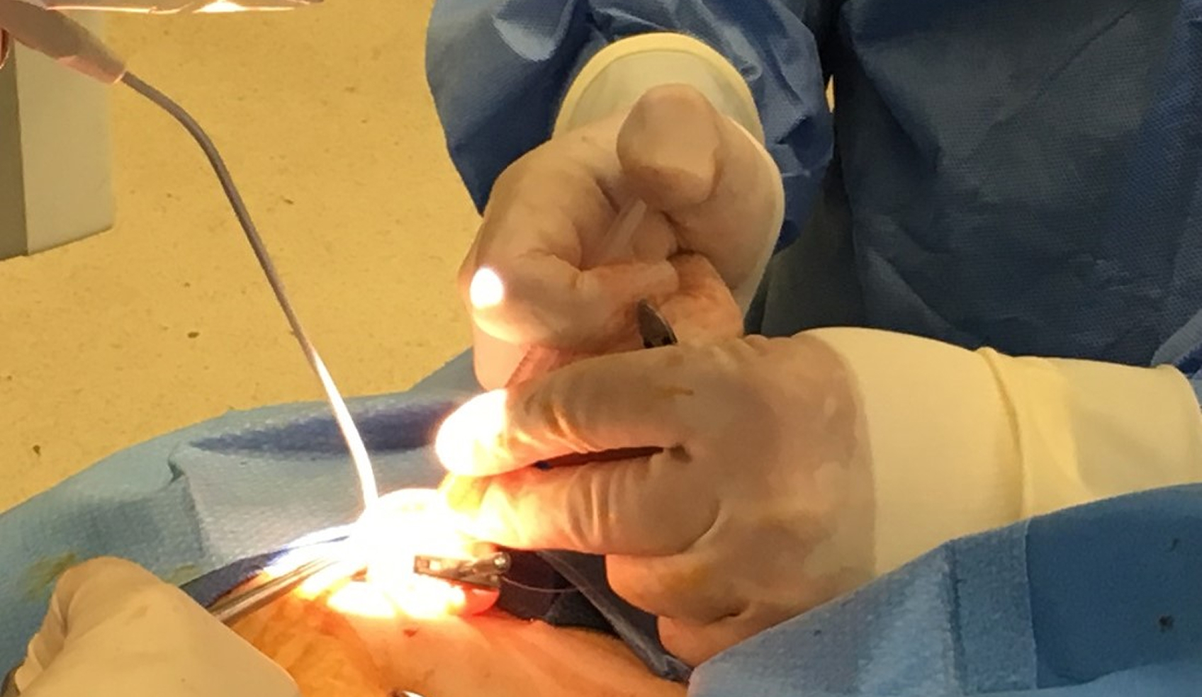 Surgical disc repositioning procedure addressing TMJ disc displacement in adolescent patient